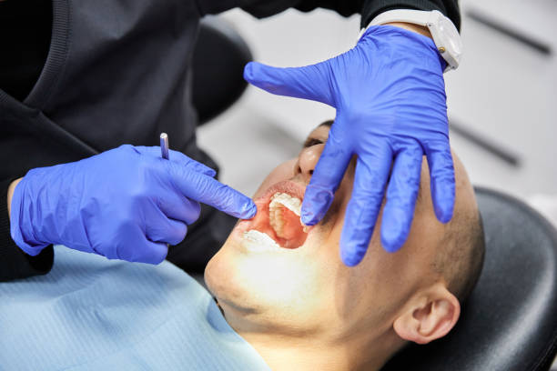 Best Emergency Gum Treatment in White Oak, OH
